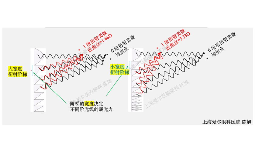 蔡司三焦点人工晶状体光学设计原理