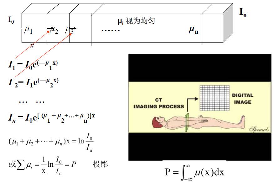 医院里CT成像基本原理