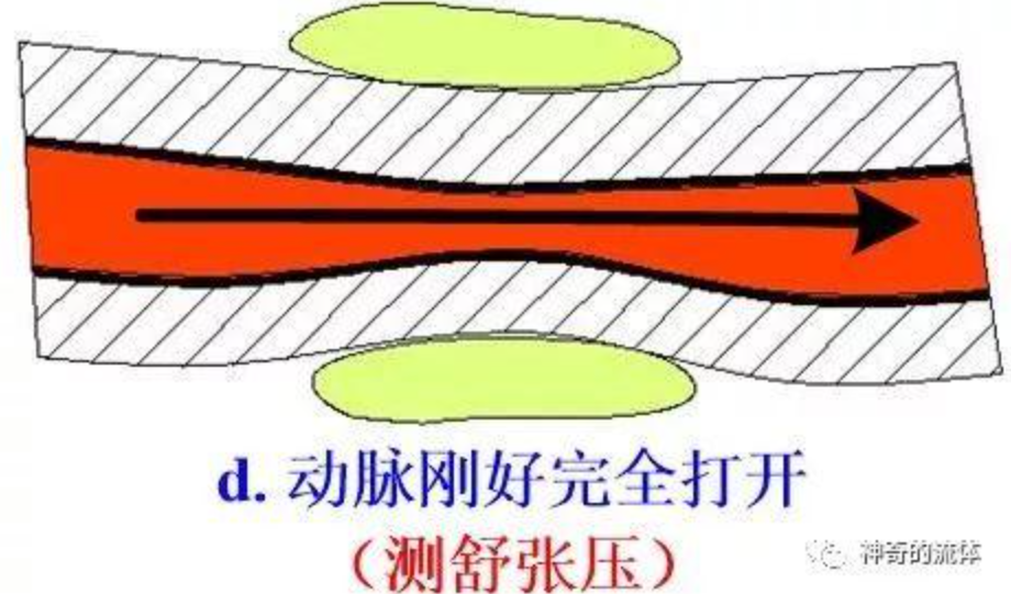 水银血压计如何测血压？血压计的原理是什么？